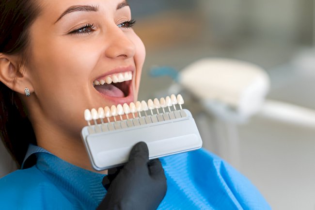 Maintaining Your Veneers: Tips from a New Albany, MS Dental Expert