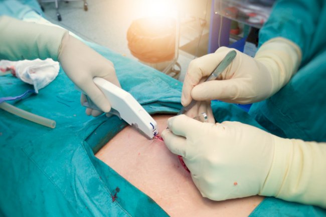 Establishing a Medical Stapler Manufacturing Plant Report 2025, Project Cost Details