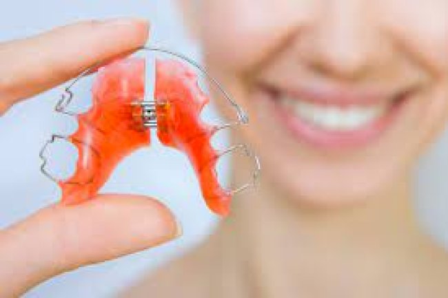 How to Store Retainers Safely When Not in Use?