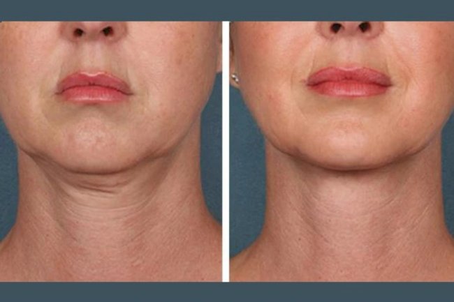 Best Plastic Surgeons in Dubai Recommended for PRP Treatment