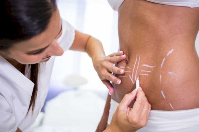 Body Contouring in Islamabad: What Locals Are Saying