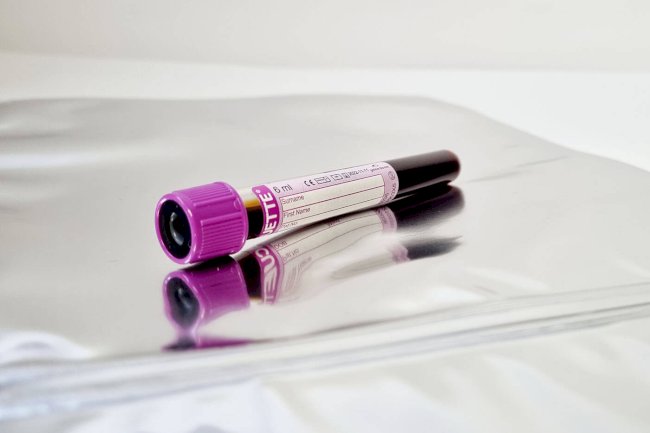 DNA Test Reliability Over Time: Does Science Change the Results?
