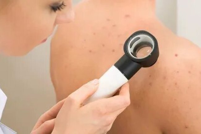 Exploring Preventive Skin Care Strategies at Dermatech Polyclinic