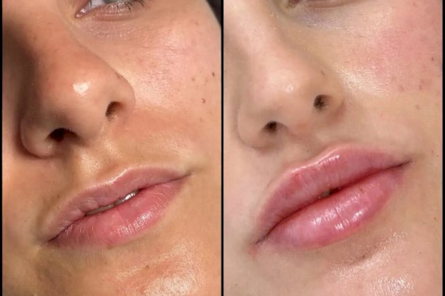 Best Plastic Surgeons in Dubai for Fillers and Stunning Jawline Definition