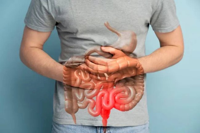 Risk Factors for Rectal Prolapse You Should Know 