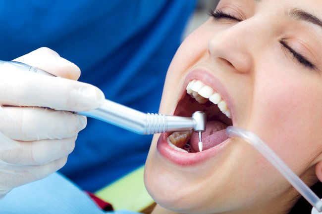 Sedation Dentistry in Calgary: A Guide to Comfortable Dental Care