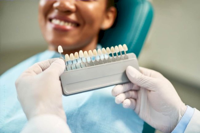 what factors affect the cost of full-mouth porcelain teeth