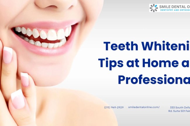 Teeth Whitening Tips at Home and Professionally
