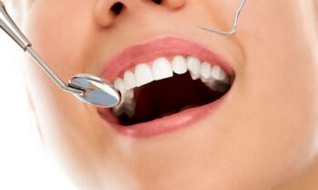 What to Expect on Your First Visit to a Dentist in Mernda