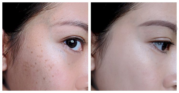 Expert Tips for Applying Serums to Maximize Glow