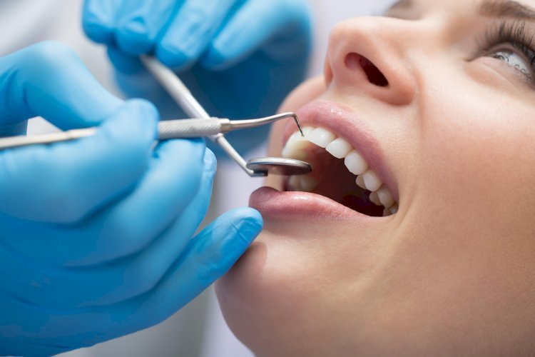 Everything You Need to Know About Dental Implants