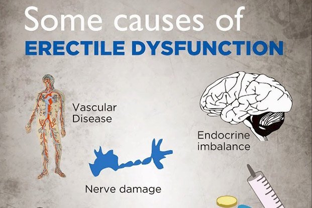 Erectile Dysfunction: Causes, Treatment Options, and Effective Solutions