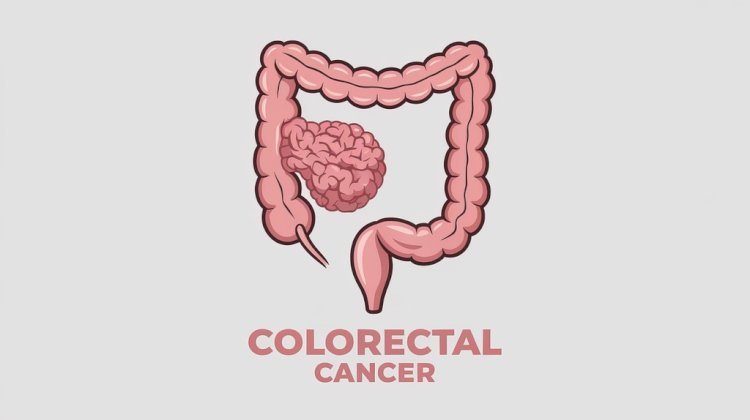 How Colorectal Surgeons Aid in Early Cancer Detection