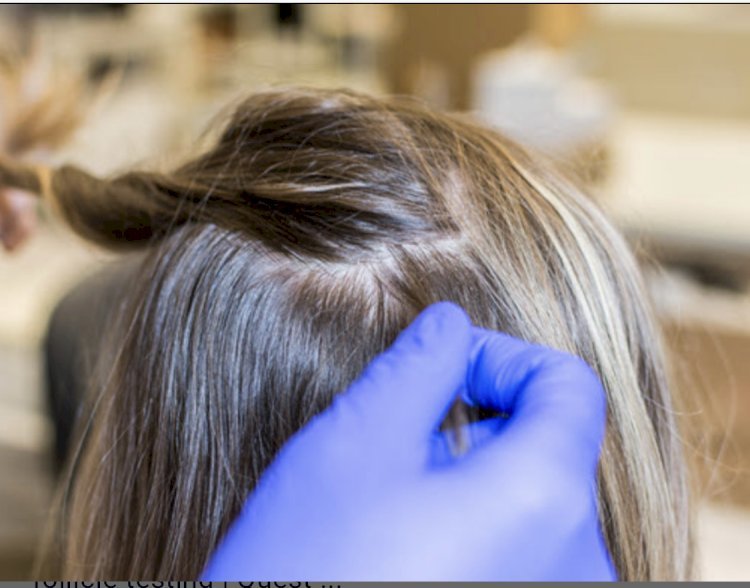 Understanding Cutoff Levels in Hair Follicle Drug Testing