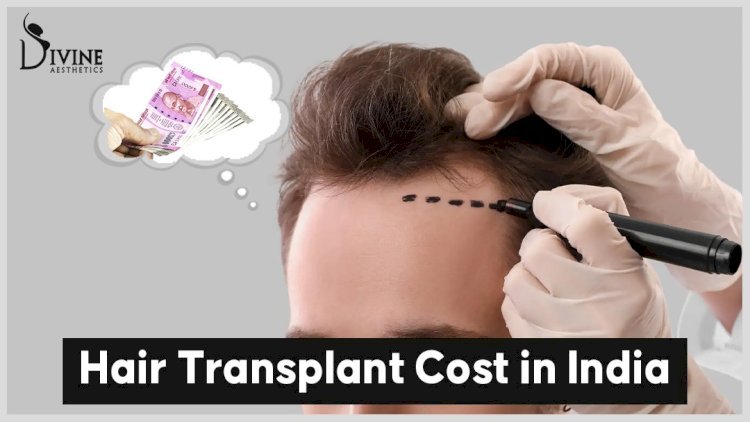 Does a hair transplant come under mediclaim?