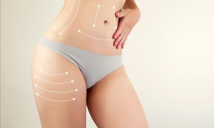 What to Expect During Your Stomach Liposuction in Dubai