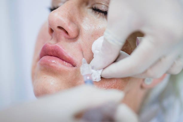 Skin Booster Injections: The Secret to a Youthful, Radiant Complexion