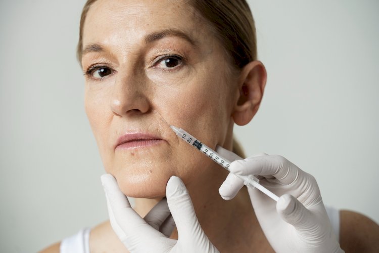 Filler for Jowls:  Solution to Restore a Youthful Jawline