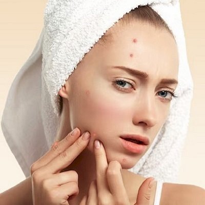 Advanced Solutions to Fade Acne Scars Naturally