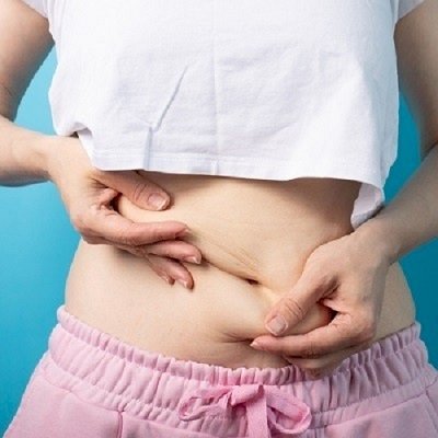 What is the Cost of Liposuction in Islamabad?