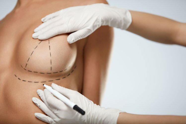 How to Choose the Right Surgeon for Your Breast Lift Procedure