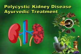 New Treatment for Polycystic Kidney Disease: Say Goodbye to Kidney Pain