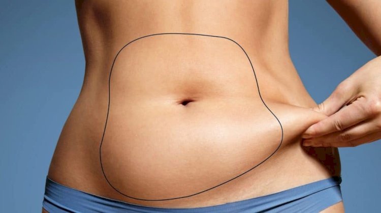 Transforming Lives The Impact of Full Body Liposuction in Dubai