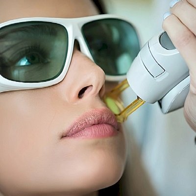 Laser Hair Removal: The Ultimate Solution for Smooth Skin