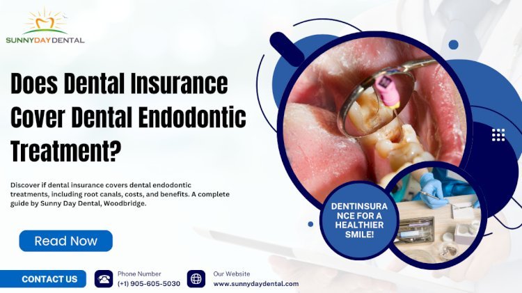 Does Dental Insurance Cover Dental Endodontic Treatment?