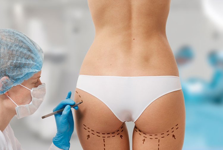 Fat Transfer Surgery in Dubai: Enhancing Your Natural Beauty