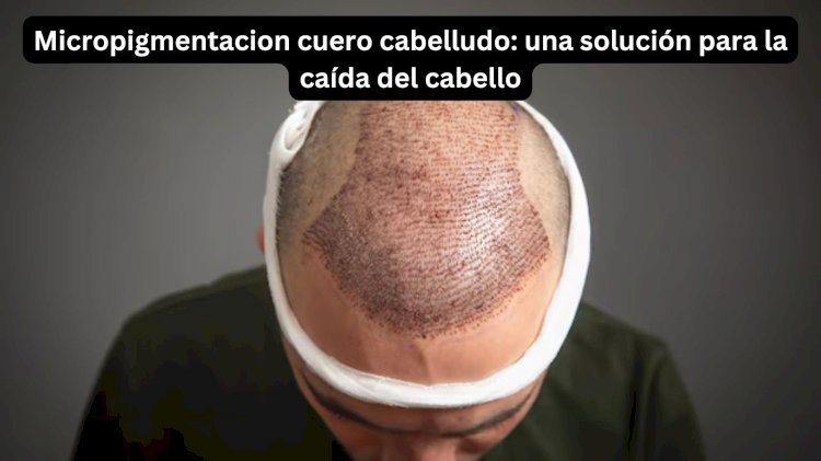 Micropigmentacion cuero cabelludo: una solución para la caída del cabello