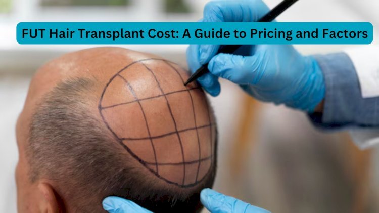 FUT Hair Transplant Cost: A Guide to Pricing and Factors