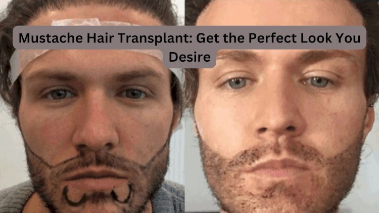 Mustache Hair Transplant: Get the Perfect Look You Desire