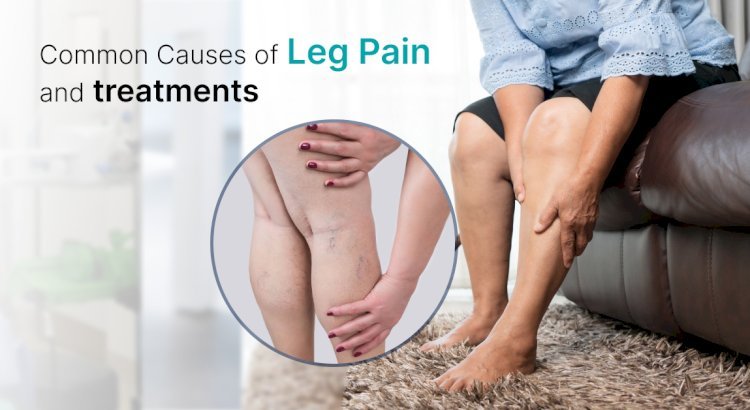 Can Leg Pain Be a Warning Sign for Blood Clots? Here’s What You Need to Know