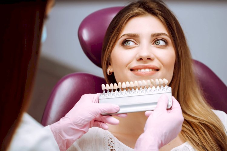 Dental Veneers: The Best Clinics in Islamabad