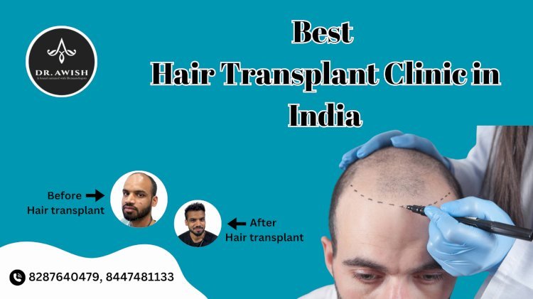  Best Hair Transplant Clinics in India