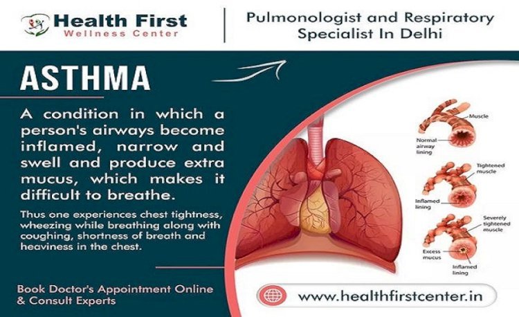 Breathe Freely Again – Consult Dr. Sanchayan Roy, The Best Asthma Specialist