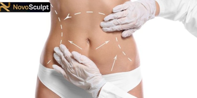 The Benefits of NovoBreast Fat Transfer: Achieving a Natural-Looking Enhancement