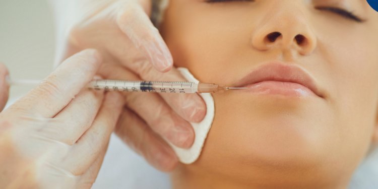 The Rise of Dermal Fillers: Why They’re Trendier Than Ever