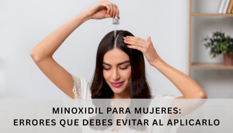 Minoxidil para mujeres: Errores que debes evitar al aplicarlo