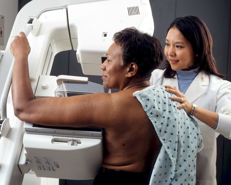 What You Should Know Before a Mammogram in San Antonio
