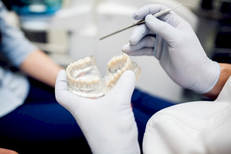 Why Marietta Dental Implants Are the Gold Standard in Tooth Replacement