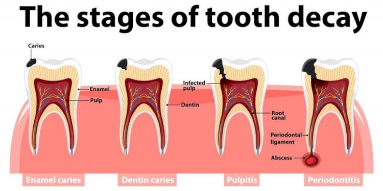 Overview of Toronto Root Canal Clinic in London