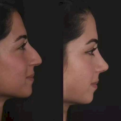 Best Septoplasty Surgeons in Dubai: Who They Are and What Sets Them Apart