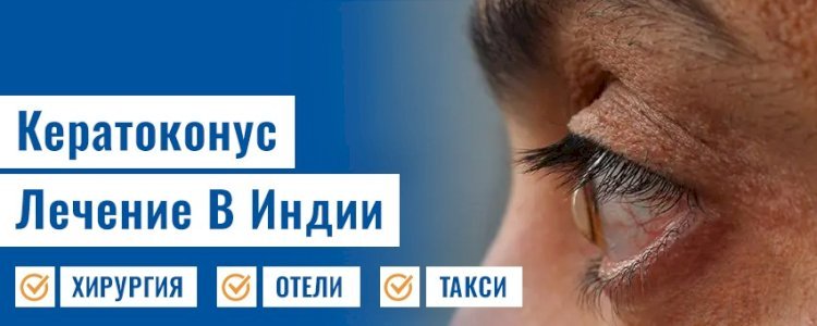 Какие у меня есть варианты кератоконус лечение?