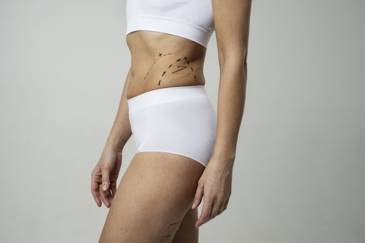 Liposuction in Dubai Demystified The Essential Guide to a Sleeker You