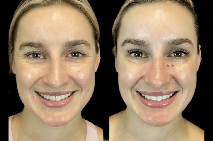 First-Time at the Best Aesthetic Clinic in Dubai? Here’s What to Know Before You Go