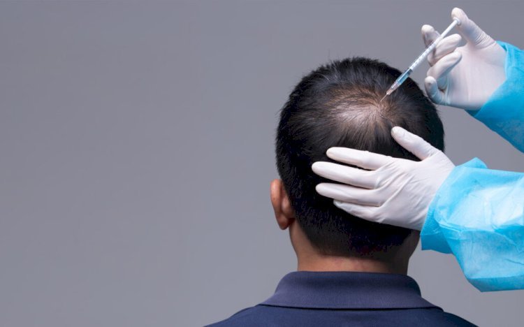 Can Minoxidil Help Regrow Hair? Detailed Insights for Men and Women
