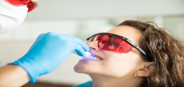 Top 5 Reasons to Choose Professional Teeth Whitening Over Store-Bought Kits