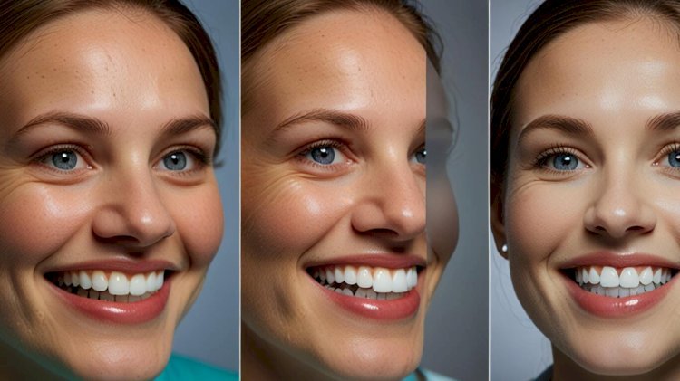 From Irritation to Clarity: Surfer’s Eye Removal and LASIK SMILE Surgery Explained